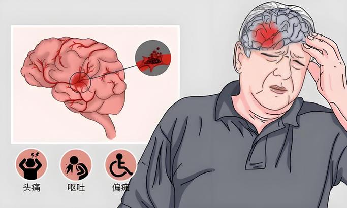美国干细胞治疗恢复期_美国细胞修复_美国细胞疗法