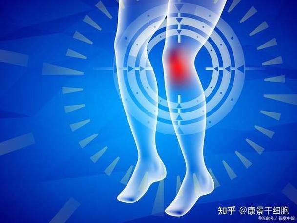 日本膝关节干细胞治疗_日本干细胞治疗膝盖多少钱_膝关节干细胞最新