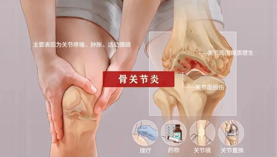 德国干细胞治疗关节痛有效吗_细胞治疗骨关节_国外干细胞治疗骨关节炎