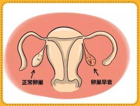 卵巢抗衰干细胞的价格_泰国干细胞治疗卵巢早衰_泰国卵巢保养