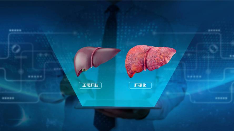 肝硬化干细胞疗法_德国干细胞治疗肝硬化_干细胞疗法治疗肝硬化费用