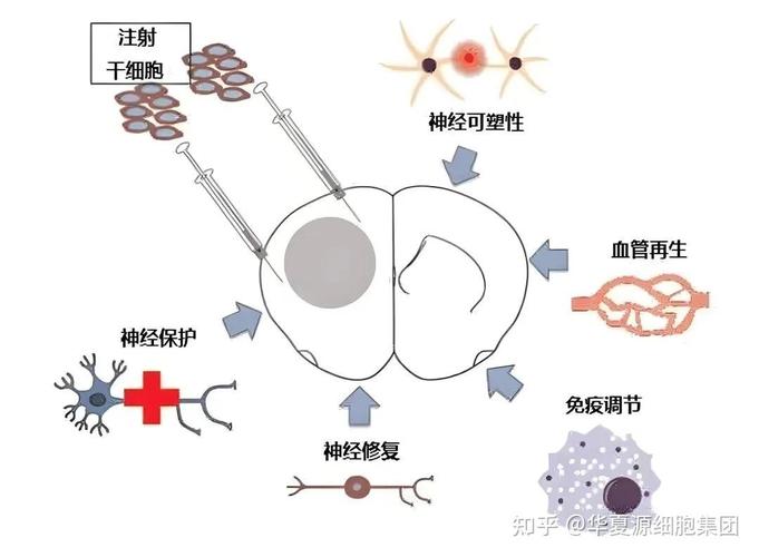 乌克兰干细胞治疗中心_乌克兰干细胞治疗帕金森_国外干细胞治疗帕金森
