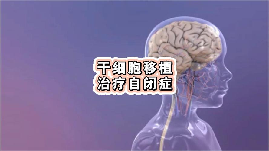 自闭症干细胞治疗_美国干细胞治疗自闭症_自闭症干细胞治疗效果如何