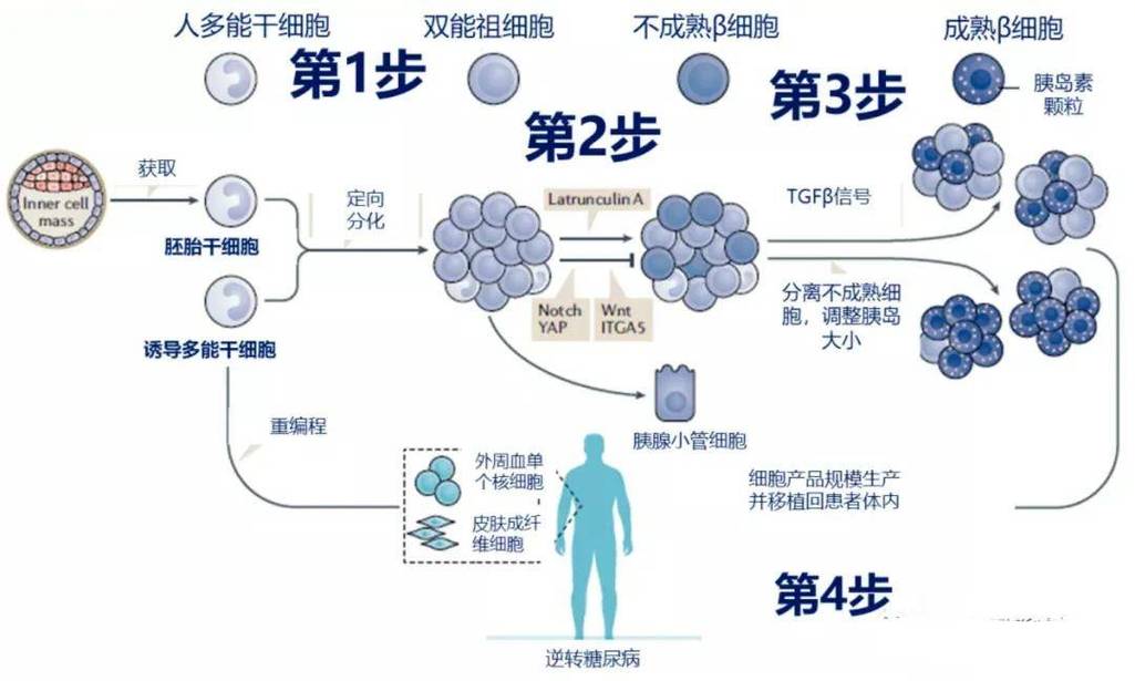 日本干细胞治疗糖尿病_日本糖尿病干细胞疗法_日本首家用干细胞治糖尿病
