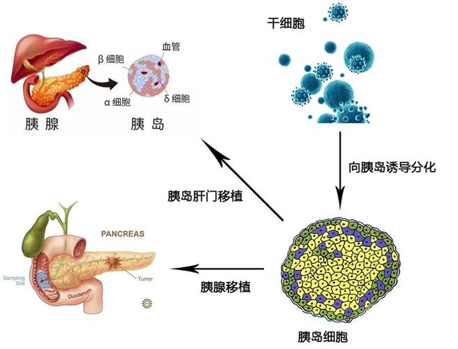 细胞治疗Lesson_德国干细胞最新技术_德国干细胞治疗多少钱