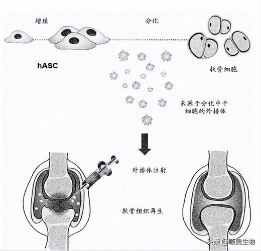 骨性关节炎干细胞治疗_日本干细胞关节炎治疗_干细胞治疗关节炎2018