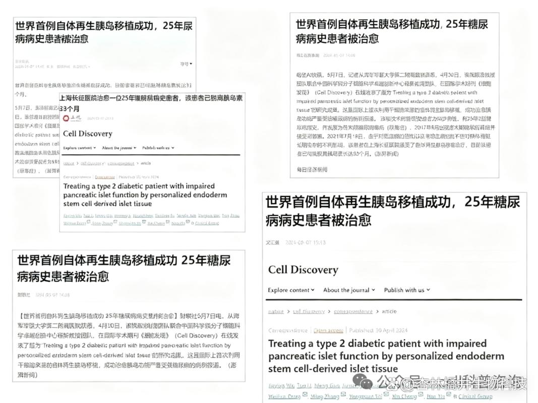 细胞治疗糖尿病最新进展_日本干细胞治疗糖尿病_细胞治疗糖尿病最新方法