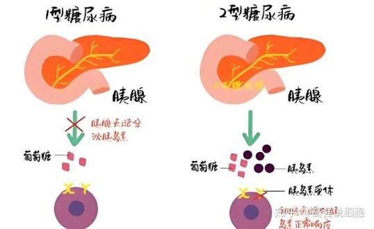乌克兰干细胞治疗多少钱_乌克兰干细胞的效果_乌克兰胚胎干细胞价格