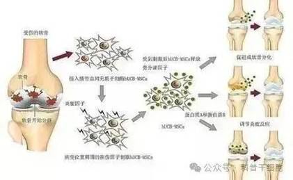 干细胞治疗关节炎2018_关节腔注射干细胞的药叫啥名_美国干细胞关节治疗价格